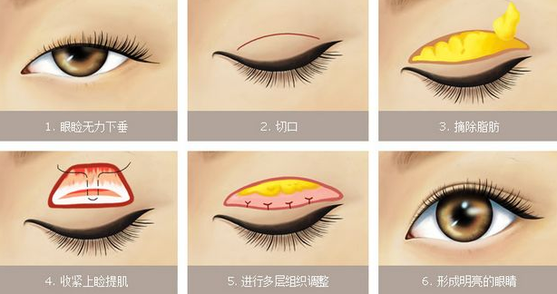 �����´�