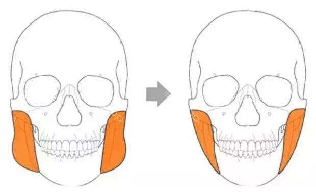 ע��΢����������Ǯһ��