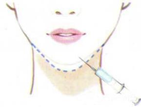 �°�����