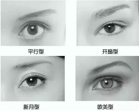 双眼皮
