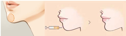 ���°������������￪���ģ�