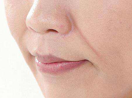 想要祛除面部的法令纹很难吗?