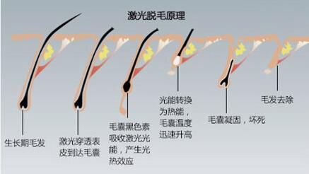 腿毛要如何脱又快又好?