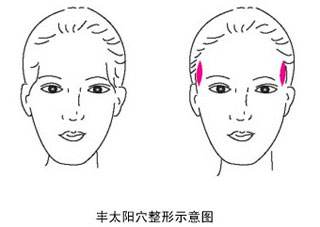 注射一针玻尿酸可以维持多久?