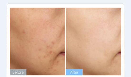 ���������۷�����Ӧ��Ⱥ����Щ��