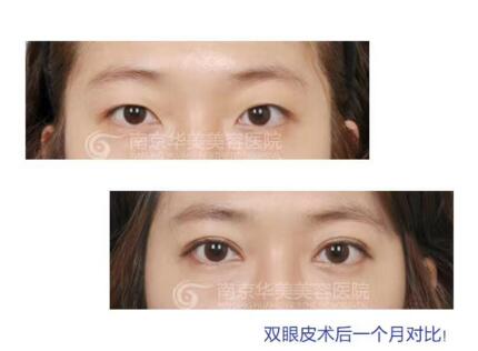 ������˫��Ƥ������Ҫע������