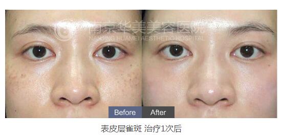 ������ߵ�Ч����ĺܺ���?