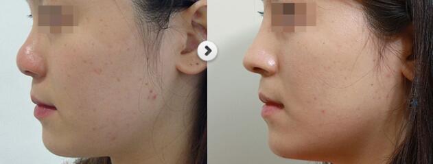 ��¡��ѡ���ļ�ҽԺ�ȽϺ���