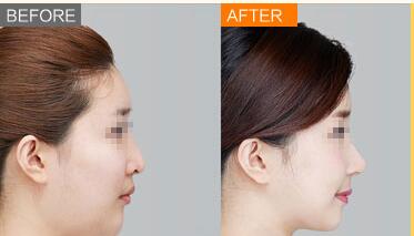 ��¡��������ú���ϴ����