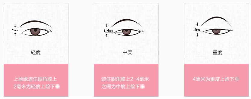 �����´�