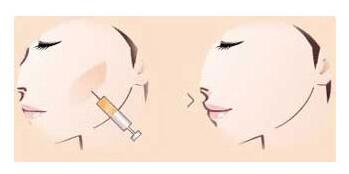 �Ͼ����沿�����̣�