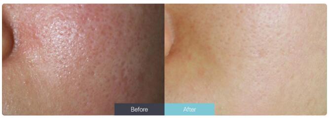 �Ͼ�����������ë�׺���ô����