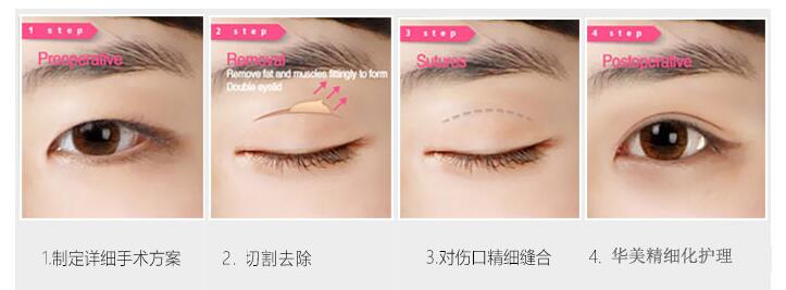 ����Ƥ��˫��Ƥ�ķ���?