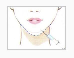 �°Ͷ�С��ʲô�������Ը���?