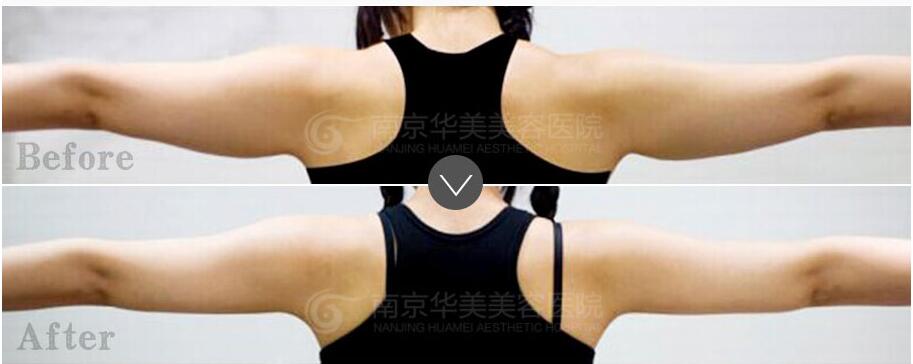 �Ͼ������ݸ첲�ķ���?