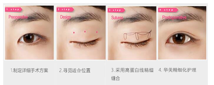 �Ͼ�������˫��Ƥ��ᱻ��������?