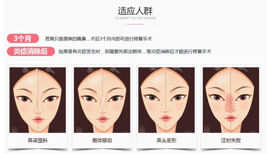 �Ͼ���¡��ʧ�ܺ�����޸���