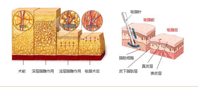 �Ͼ��沿�ж��������沿��֬��