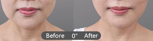 ����沿���Ƶķ�������Щ��