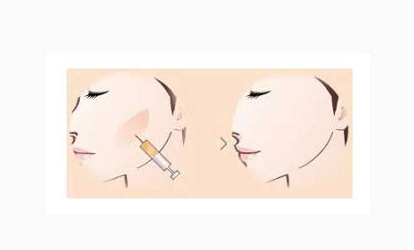 �Ͼ��������ƻ��������Σ����