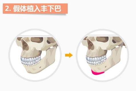 �Ͼ���������°�ά��ʱ���Ƕ�ã�