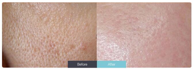 �Ͼ�����ë�׵ķ�������Щ��