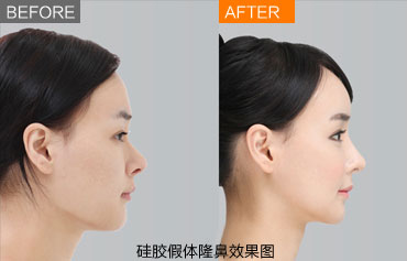 ¡������Ч����ȫ��