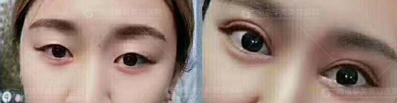 �Ͼ���˫��Ƥ�������ļ�ҽԺ��